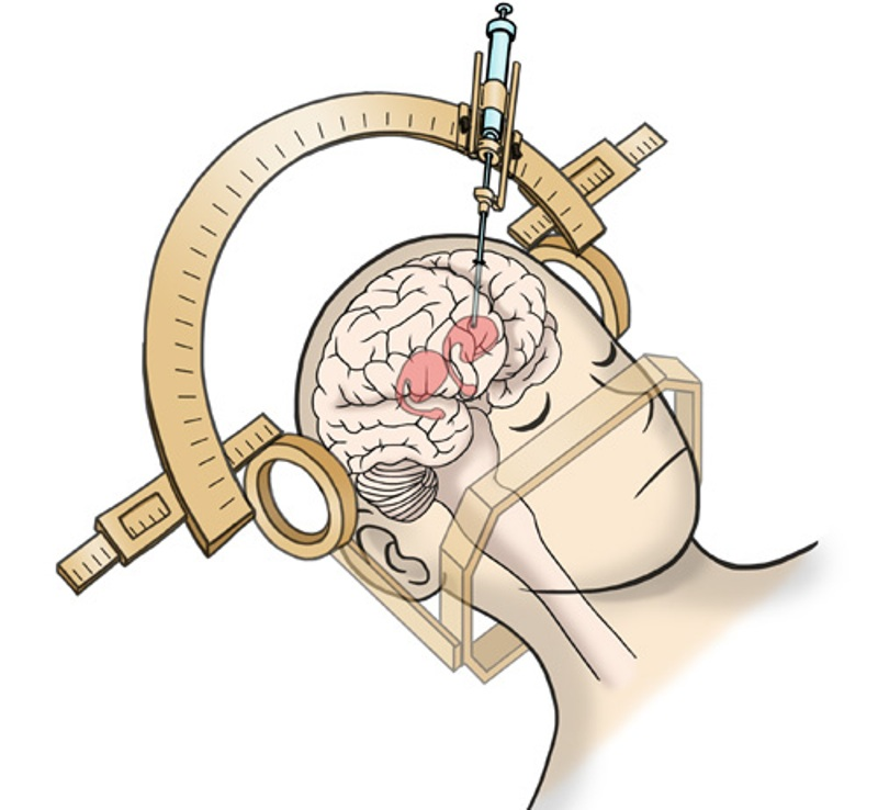 Illust: Lors de l'interventio, 478.8 ko, 800x738